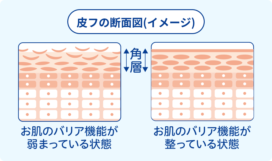 皮フの断面図(イメージ)